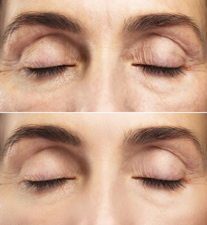 Intense Eye Revive (sb 2) - Image 4