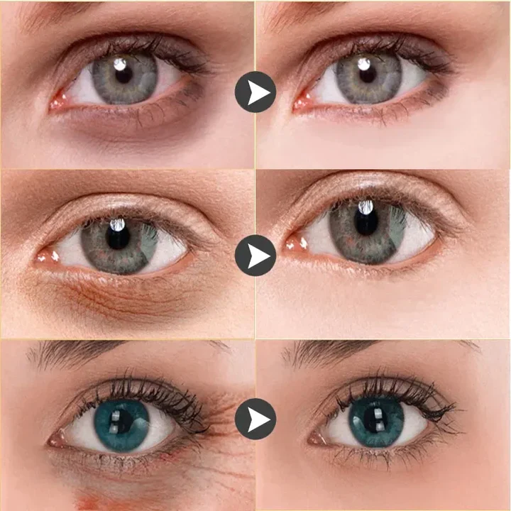 Intense Eye Revive (sb 2) - Image 6