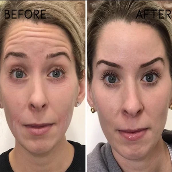 Olavita™ Serum Special Offer - Image 3